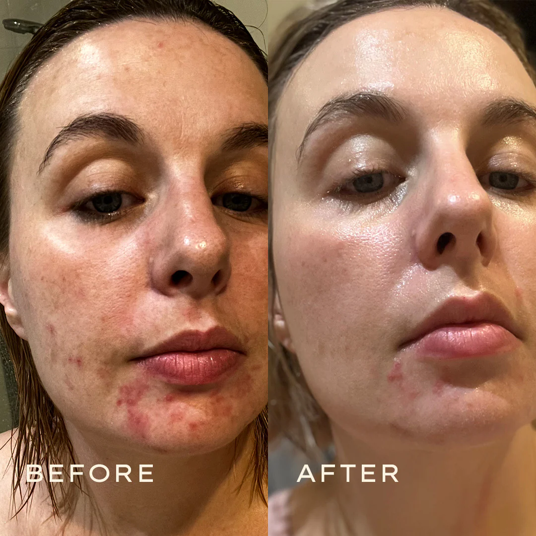 Calendula Cream - Image 9