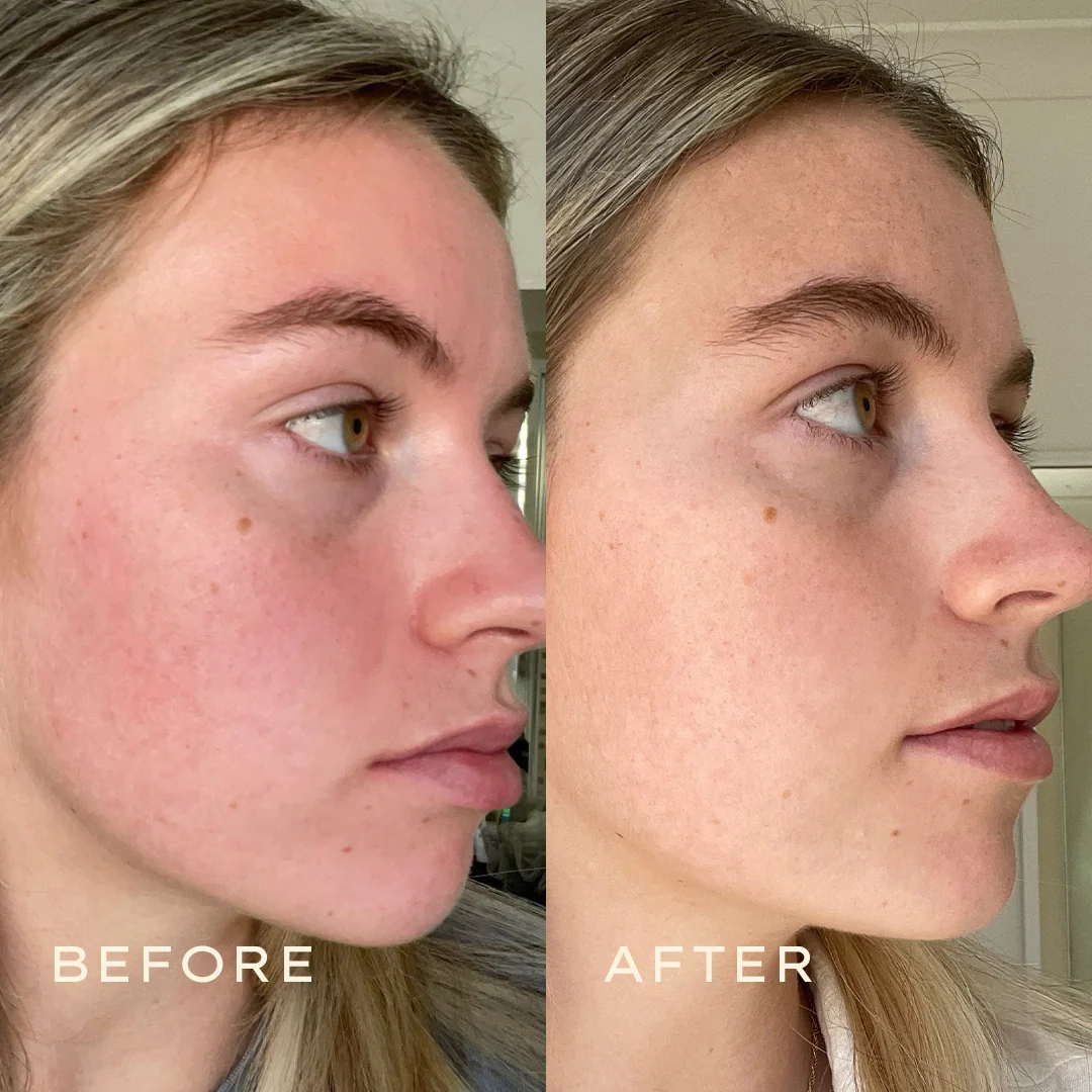 Calendula Toner - Image 8