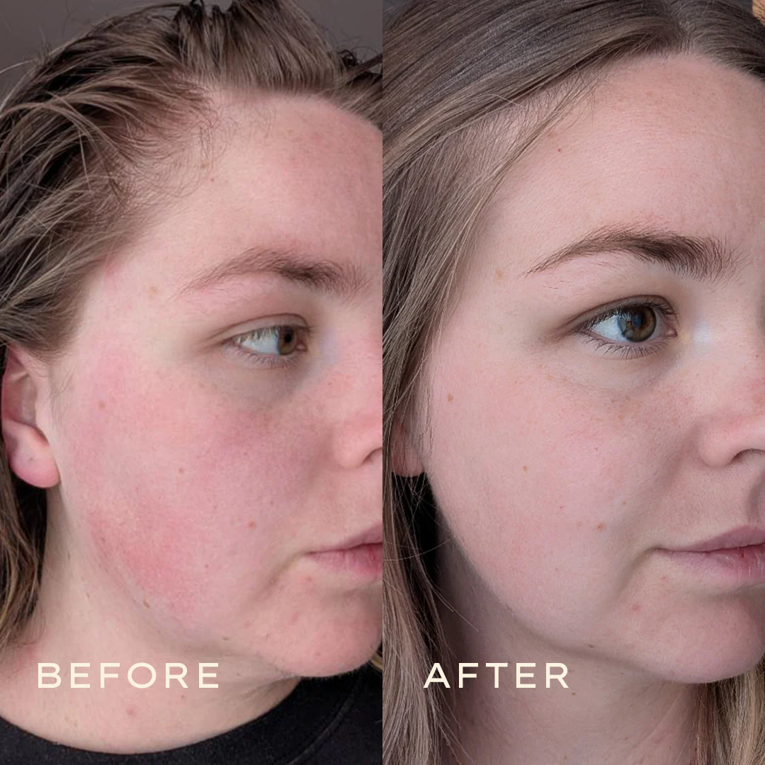 Calendula Toner - Image 9